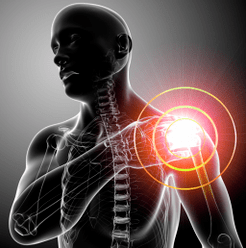 Symptômes de l'arthrose